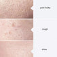 Aqua Peel Solution Serums